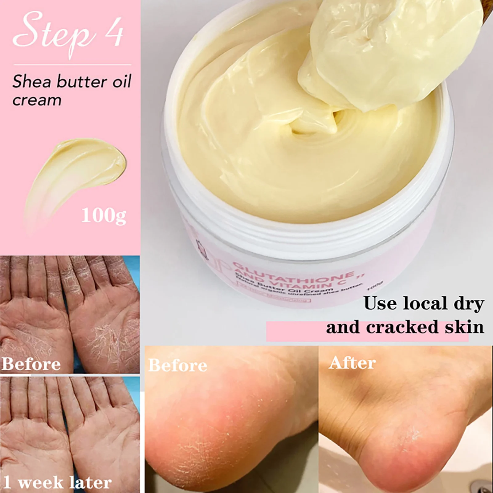 AILKE Whitening Moisturizing Korean Facial And Body Lotion, Reduce Melanin Wrinkles, Vitamin C Dark Spots Remove Skin Care Cream thumbnail 6