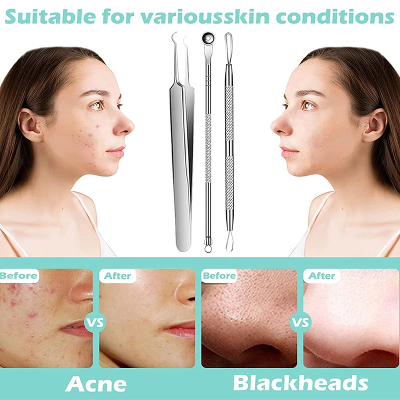 Acne Blackhead Removal Needles Stainless Steel Black Spot Blemish Pimple Removal Needle Deep Cleansing Tool Face Skin Care Kit thumbnail 2