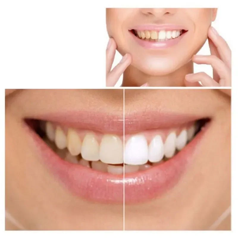 Toothpaste Dental Care 93% Advanced Tartar Solution Korea Whitening Toothpaste Smoke Stains Remove Teeth Oral Care thumbnail 5
