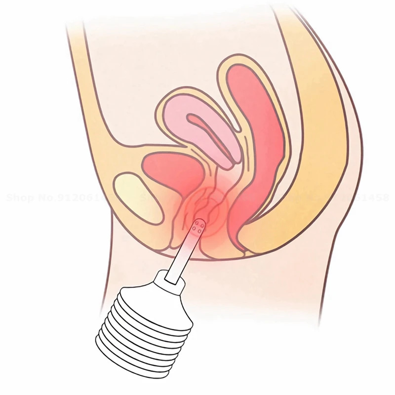 180ML Enema Cleaner Sexy Toys for Men Full Girl Anal Plug Sexy Tools Adult Toys Sex Toys for Womans thumbnail 6