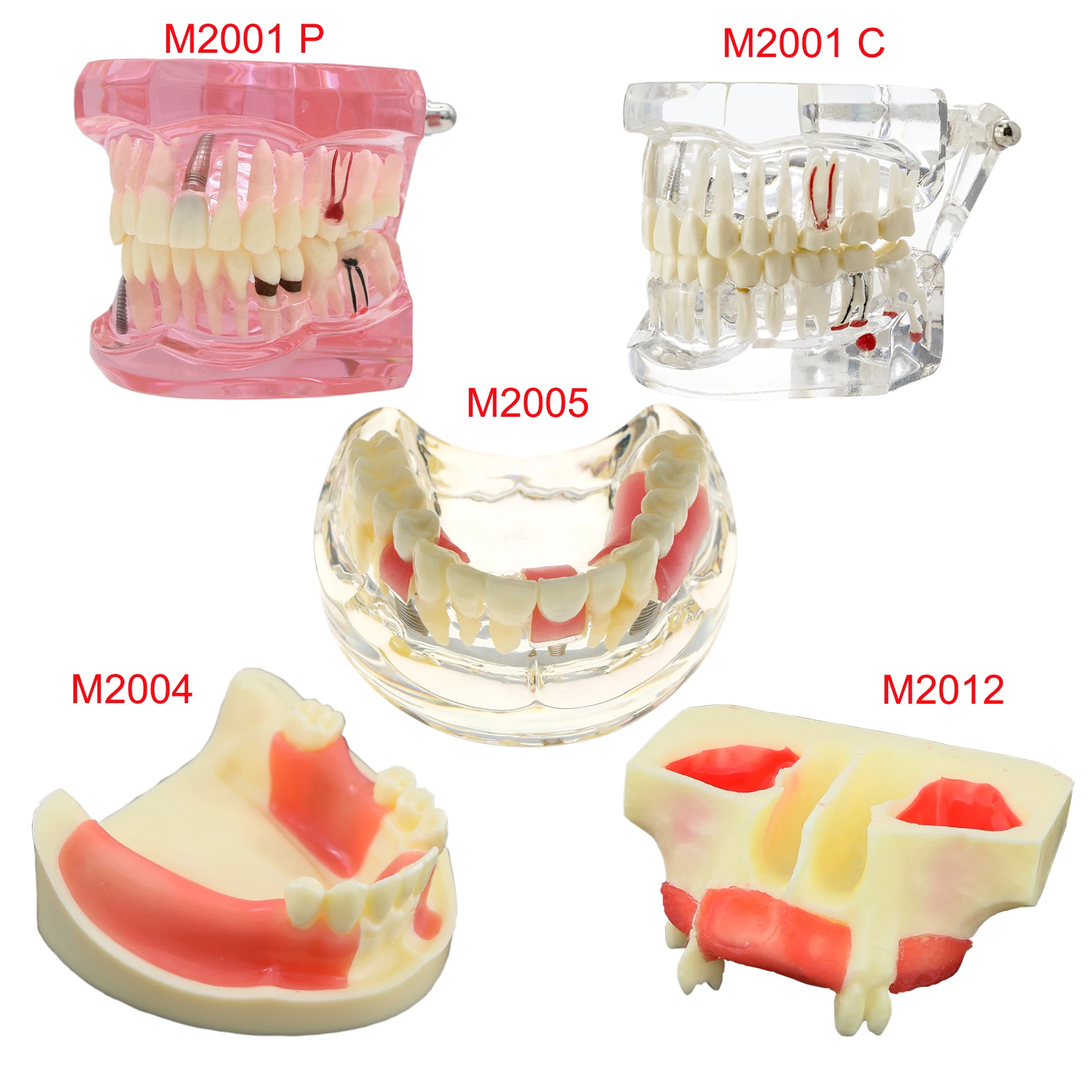 Dental Teeth Model Dental Teaching Models Implant Model Removable Dentistry Model Teeth For Training Studying Patient Education thumbnail 3