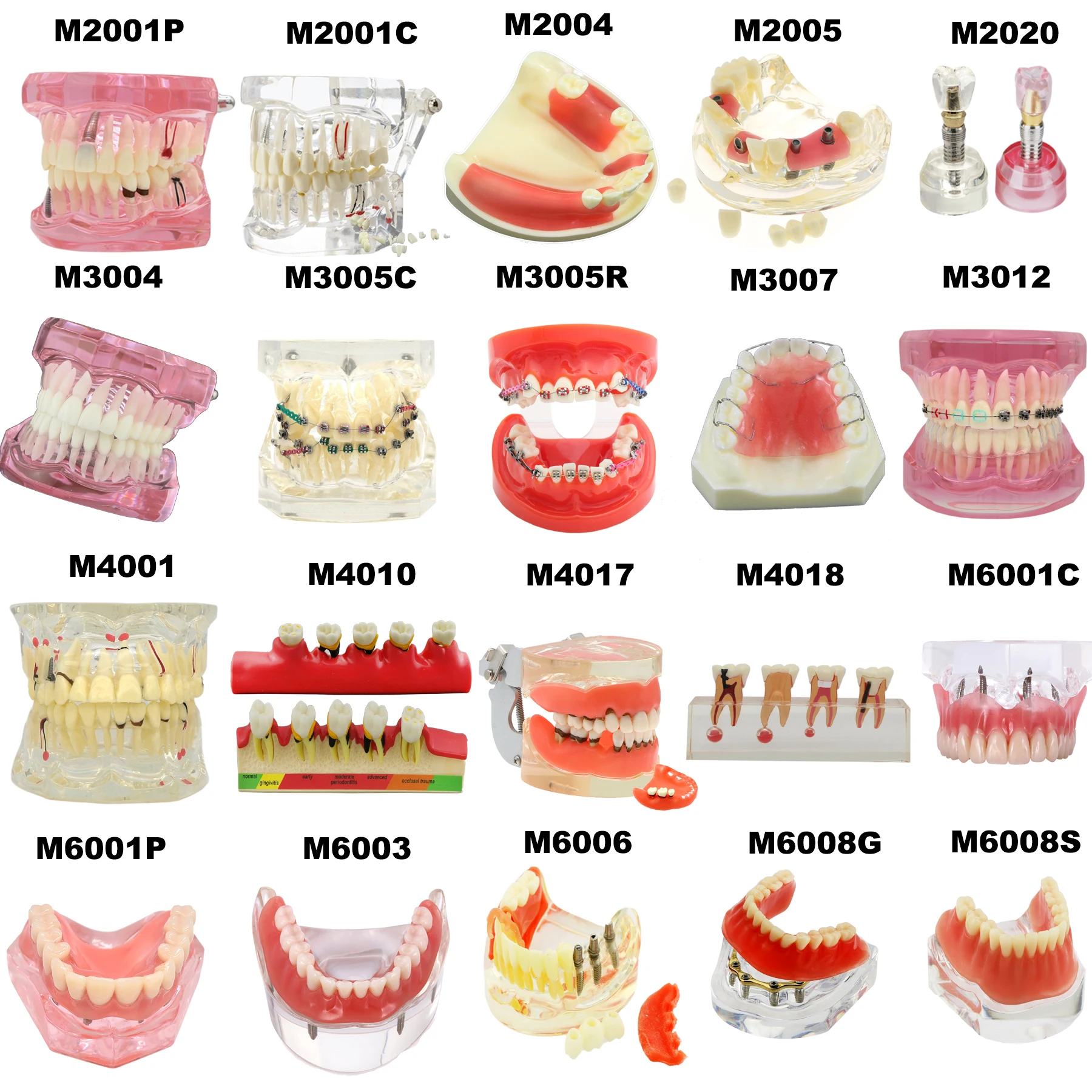 Dental Teeth Model Dental Teaching Models Implant Model Removable Dentistry Model Teeth For Training Studying Patient Education thumbnail 2