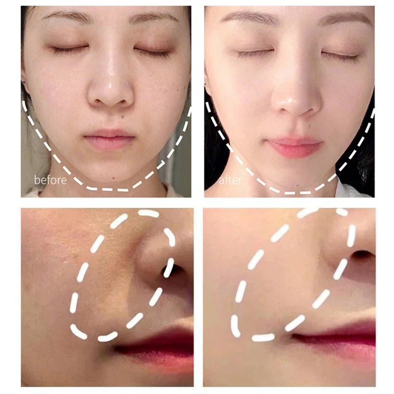 Electric Facial Beauty Devices Face Lifting Anti Wrinkle Facial Eye Massage with Face Cream Introducer Skin Rejuvenation thumbnail 4