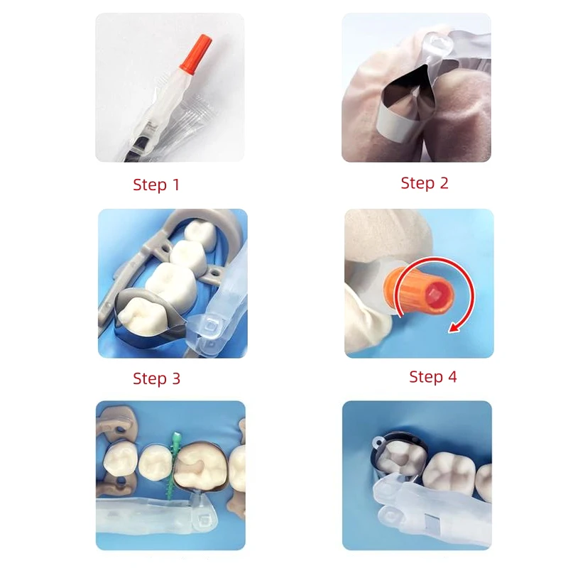 Dental Matrix Roll Type Retainer and Matrix 180° Adjustable Sectional Contoured Matrices Dental Crown Materials Dentist Tools thumbnail 5