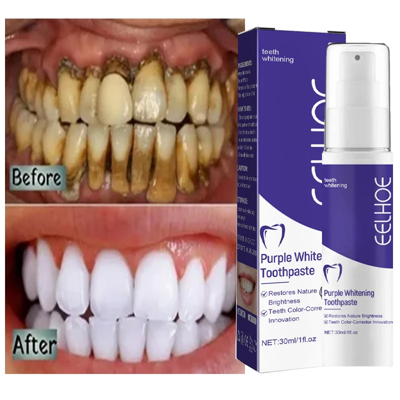 1pcs Teeth Cleansing Whitening Toothpaste Whiten Gel Whitener Bleach Removes Stains Fresh Breath Tooth Cleaning Korea Products