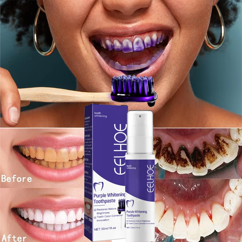 1pcs Teeth Cleansing Whitening Toothpaste Whiten Gel Whitener Bleach Removes Stains Fresh Breath Tooth Cleaning Korea Products thumbnail 3