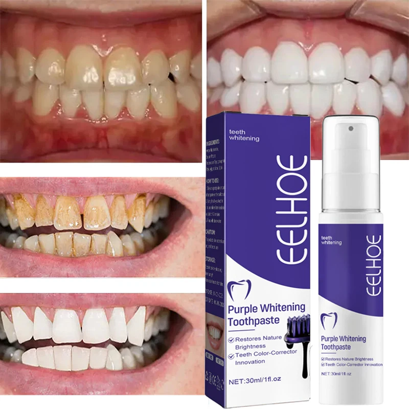 1pcs Teeth Cleansing Whitening Toothpaste Whiten Gel Whitener Bleach Removes Stains Fresh Breath Tooth Cleaning Korea Products thumbnail 5