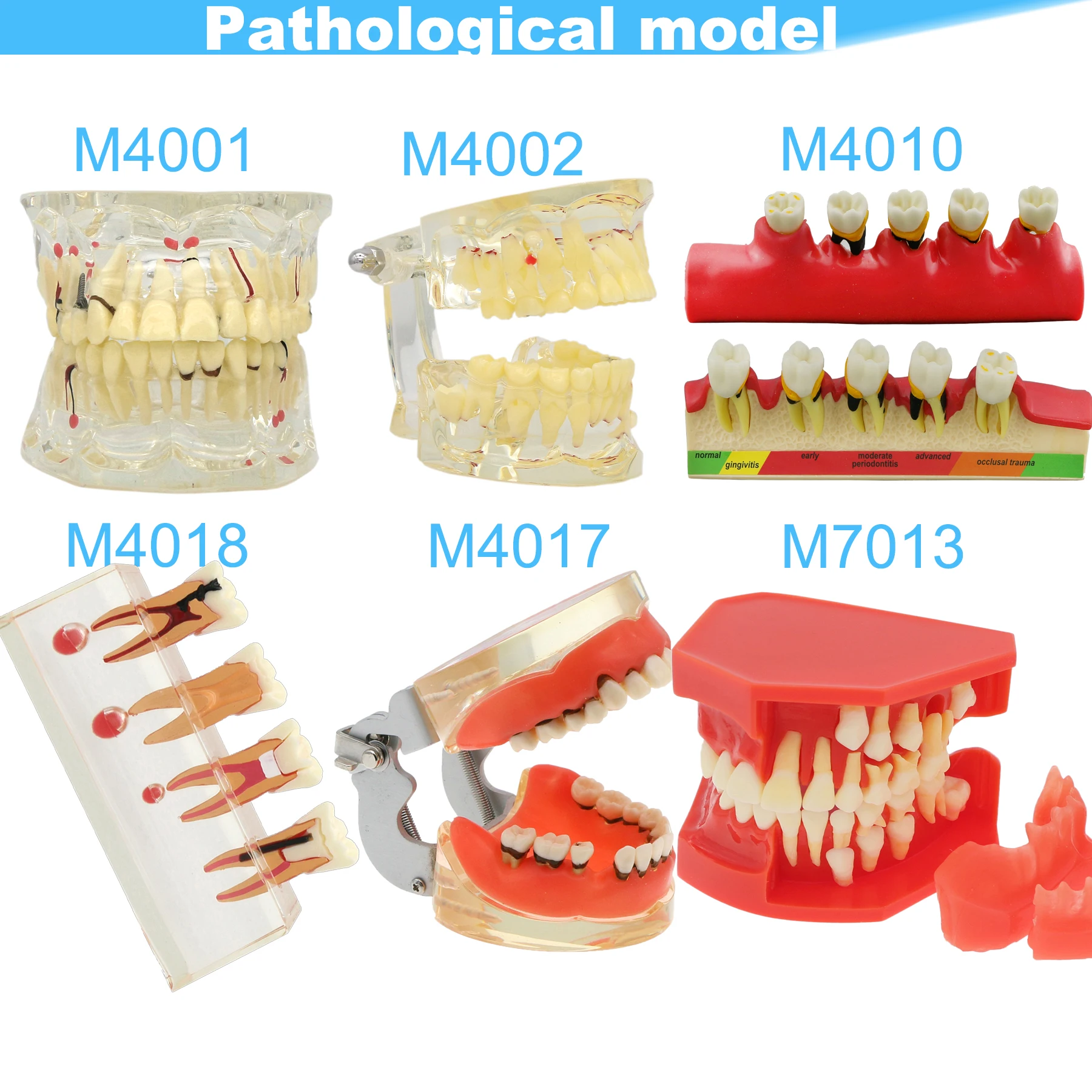 Dental Teeth Model Dental Teaching Model Standard Implants Models Orthodontic Model Dentistry Dentist  Demo Studying thumbnail 4