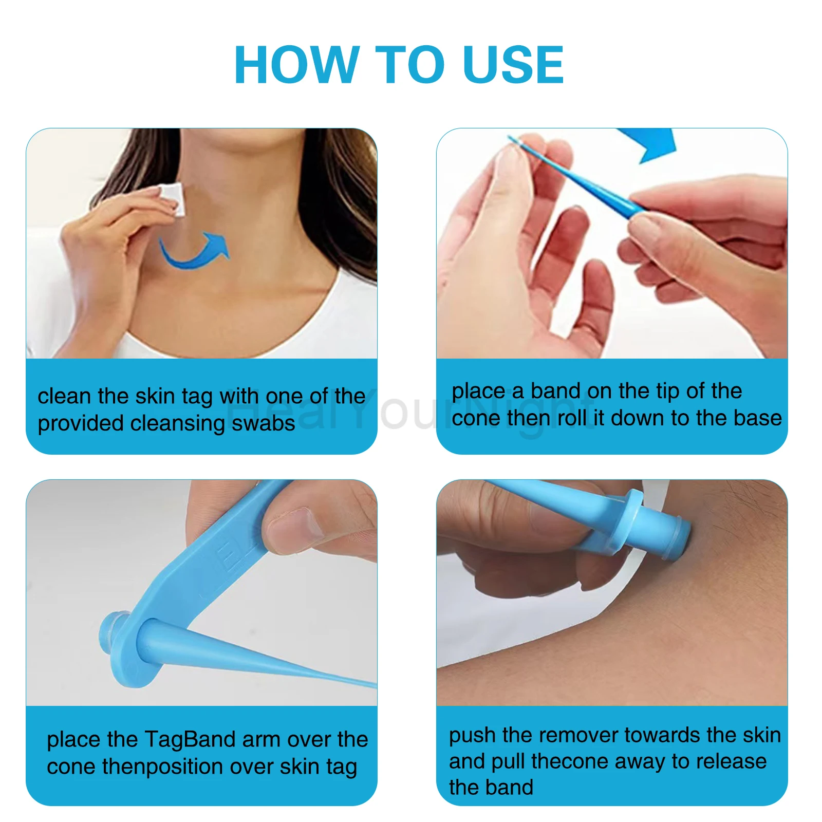 3-IN-1 Auto Skin Tag Removal Kit Painless Skin Label Mole Acne Wart Removal Pen Set with Cleansing Swabs Facial Beauty Care Tool thumbnail 3