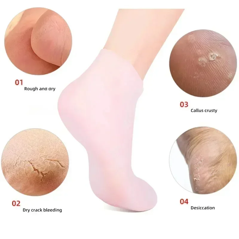 1 Pair Silicone Moisturizing Socks Exfoliating Gel Heel Socks Callus Cracked Dead Skin Remove Protector Pain Relief Foot Care thumbnail 4