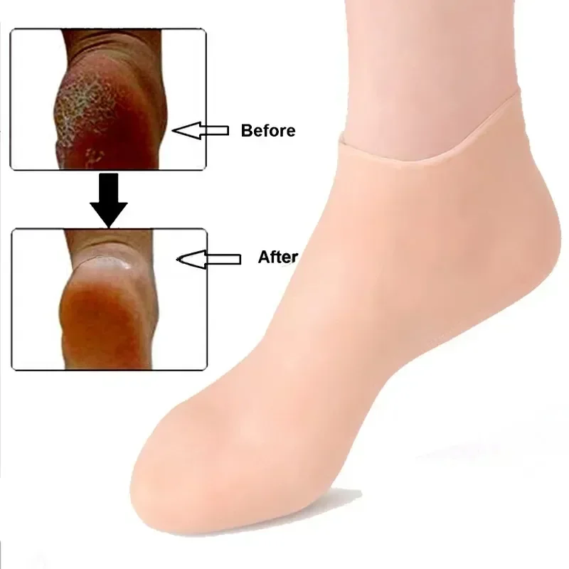 1 Pair Silicone Moisturizing Socks Exfoliating Gel Heel Socks Callus Cracked Dead Skin Remove Protector Pain Relief Foot Care thumbnail 5