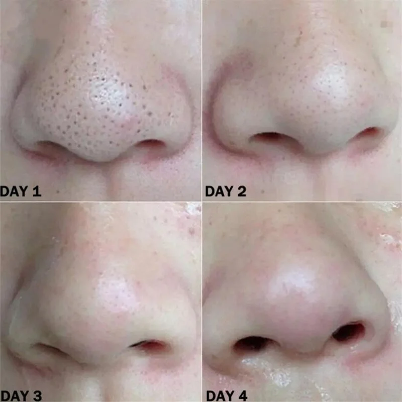 Nose Blackhead Remover Mask Nasal Strips Black Head Nose Dot Spot Peel Skin Care Shrink Pore Black dots Pore Clean Strips thumbnail 3