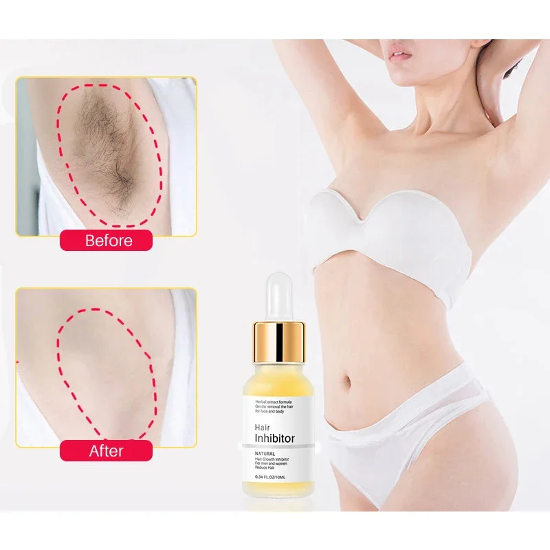 Permanent Hair inhibition Serum Painless Hair Remover Armpit Legs Arms Hair Growth Inhibitor Beauty Skin Care Body Essential Oil thumbnail 3