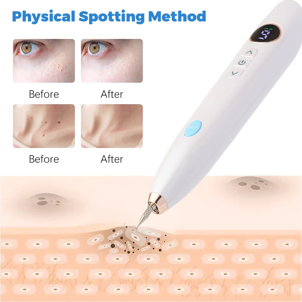 Professional Plasma Pen 9-Level Skin Face Wart Tag Household Black Dots Tattoo Freckle Remover Beauty Instrument LED Screen thumbnail 3
