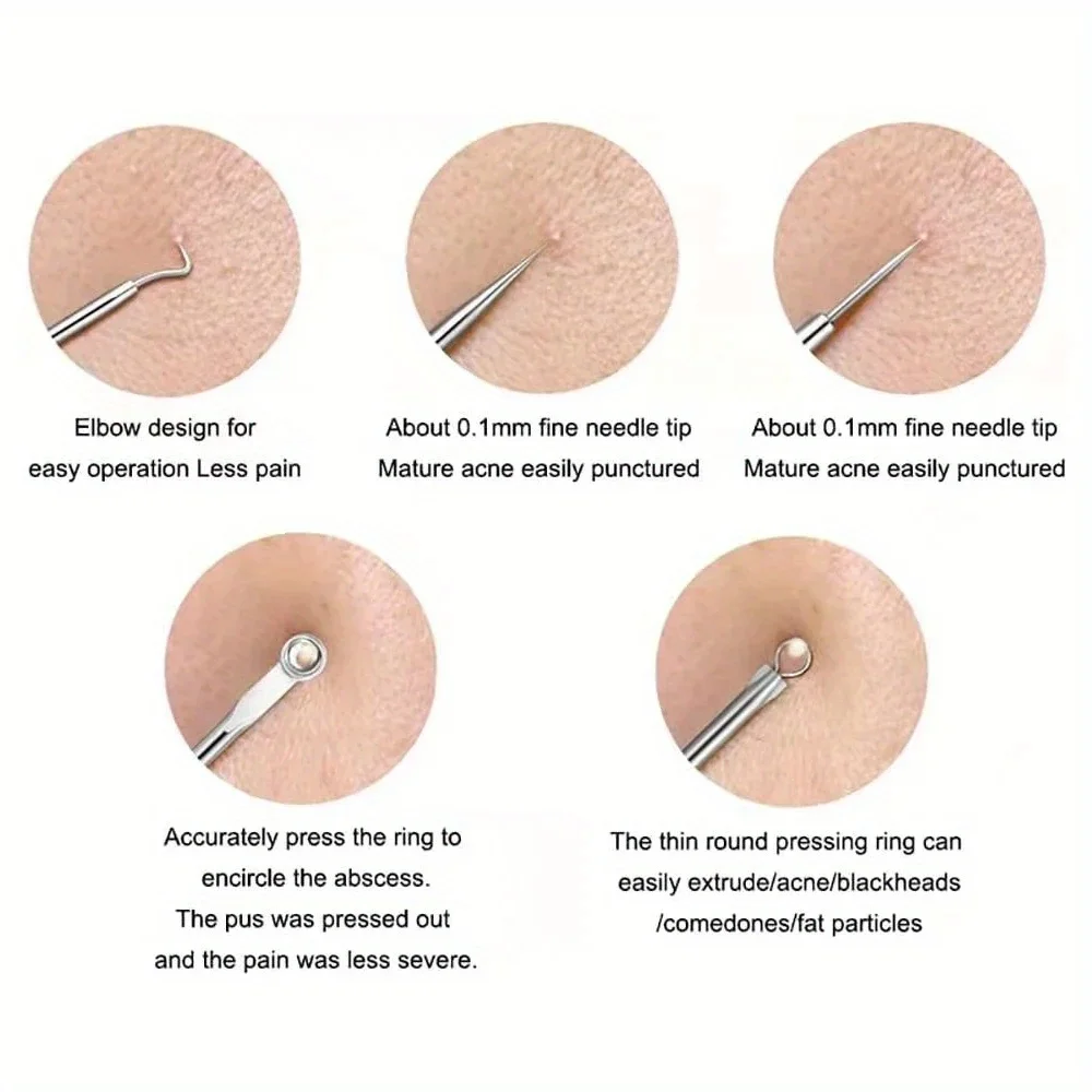 Blackhead Acne Pimple Blemish Extractor Remover Kit Stainless Steel Needles Remove Tools Face Skin Care Pore Cleaner 4pcs/bag thumbnail 2