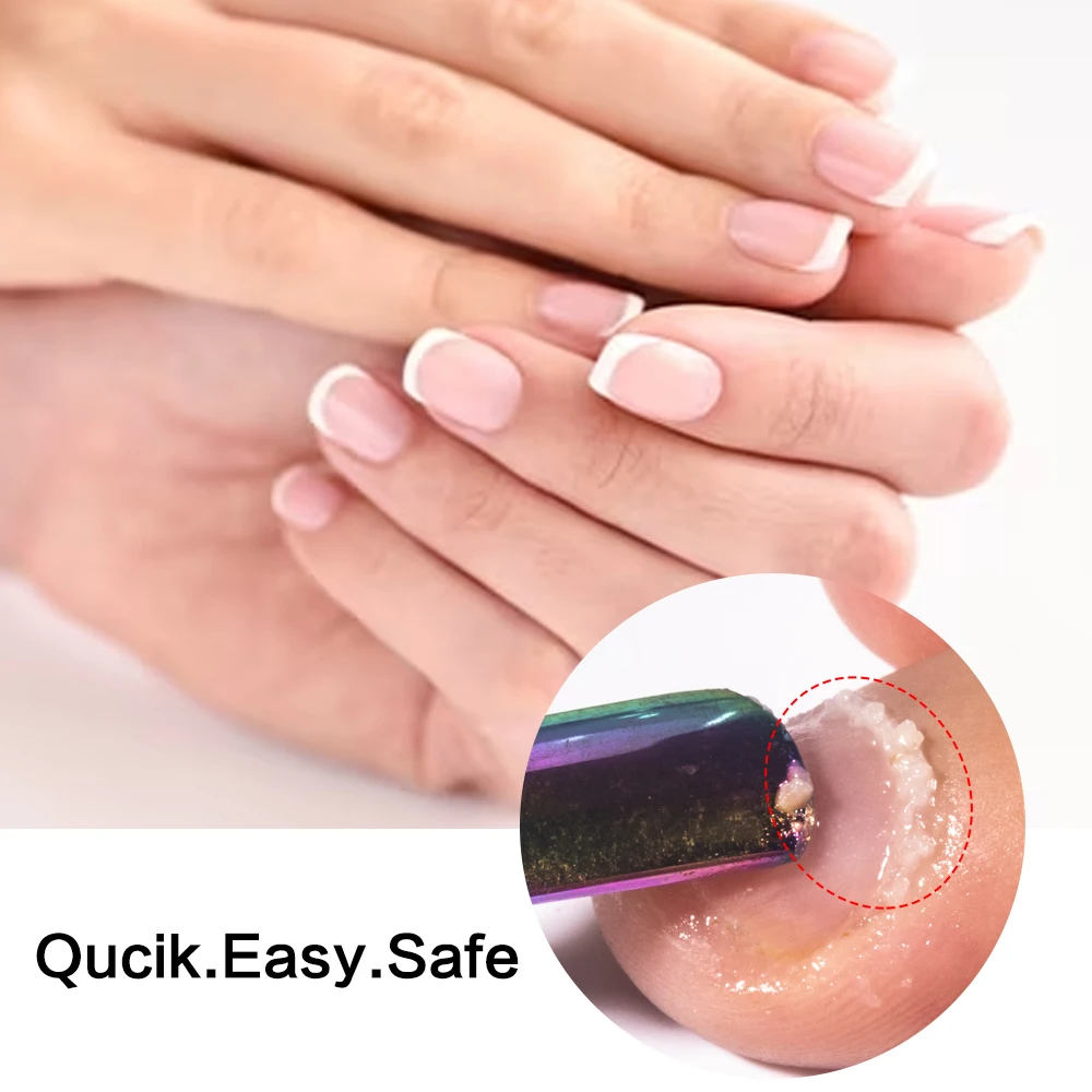 KODIES GEL Cuticle Remover 15ML Gentle Exfoliator Foot Cuticle Oil Softener Liquid Nail Art Treatment Manicure Repair Care Tools thumbnail 4