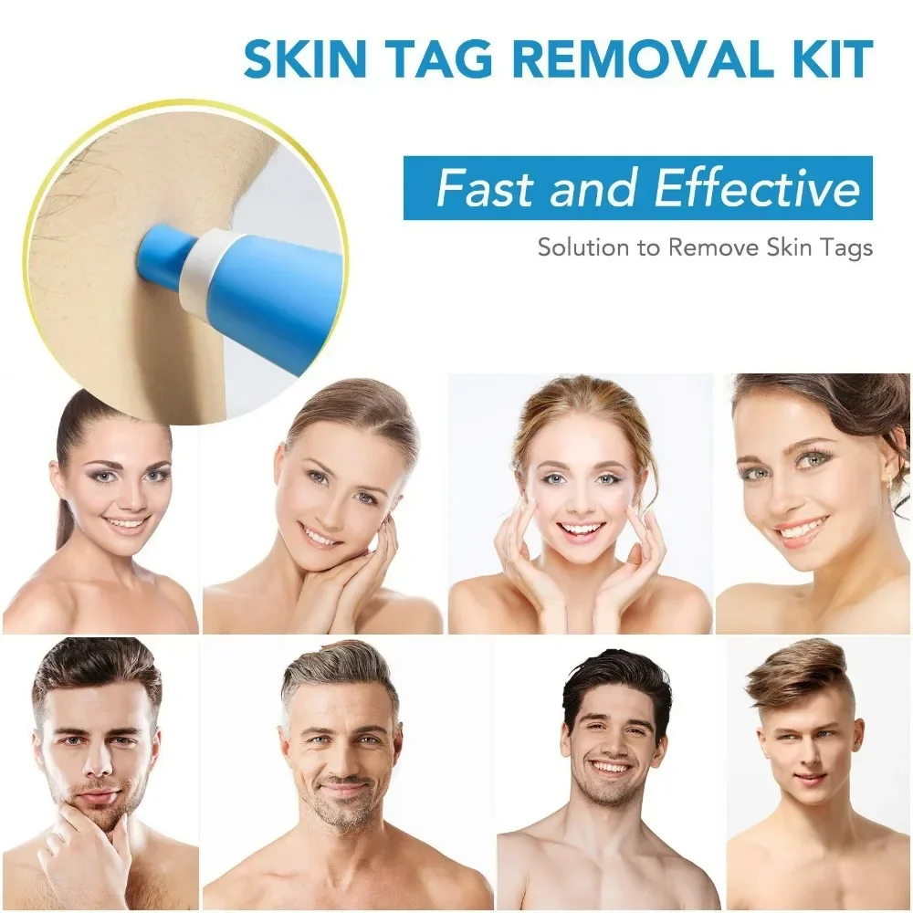 2 In1 Painless Auto Skin Tag Mole Wart Removal Kit Cleaning Tools Face Skin Care Body Wart Dot Treatments Remover Beauty Health thumbnail 3