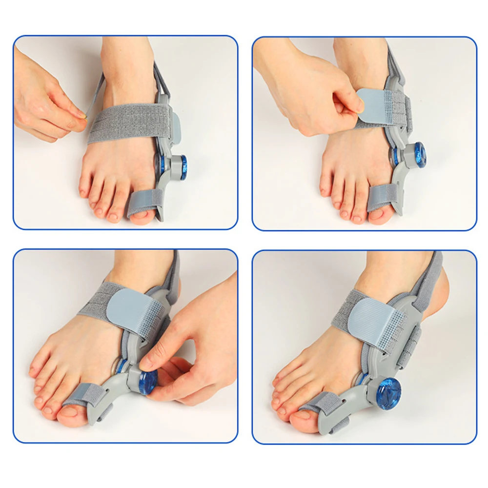 Bunion Splint Big Toe Straightener Hallux Valgus Correction Orthotics Foot Bone Thumb Adjuster Correction Bunions Corrector thumbnail 5