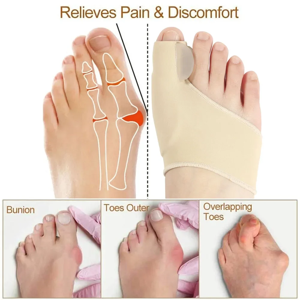 1Pair Toe Separator Bunion Corrector Toe Brace Orthopedic Hallux Valgus Relief Bone Thumb Adjuster Correction for Men and Women thumbnail 4