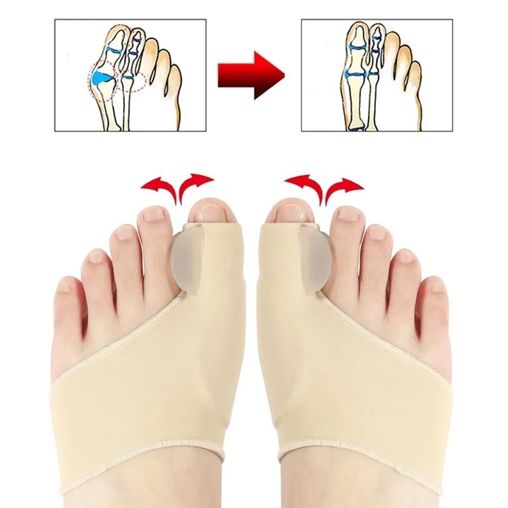 1Pair Toe Separator Bunion Corrector Toe Brace Orthopedic Hallux Valgus Relief Bone Thumb Adjuster Correction for Men and Women thumbnail 5