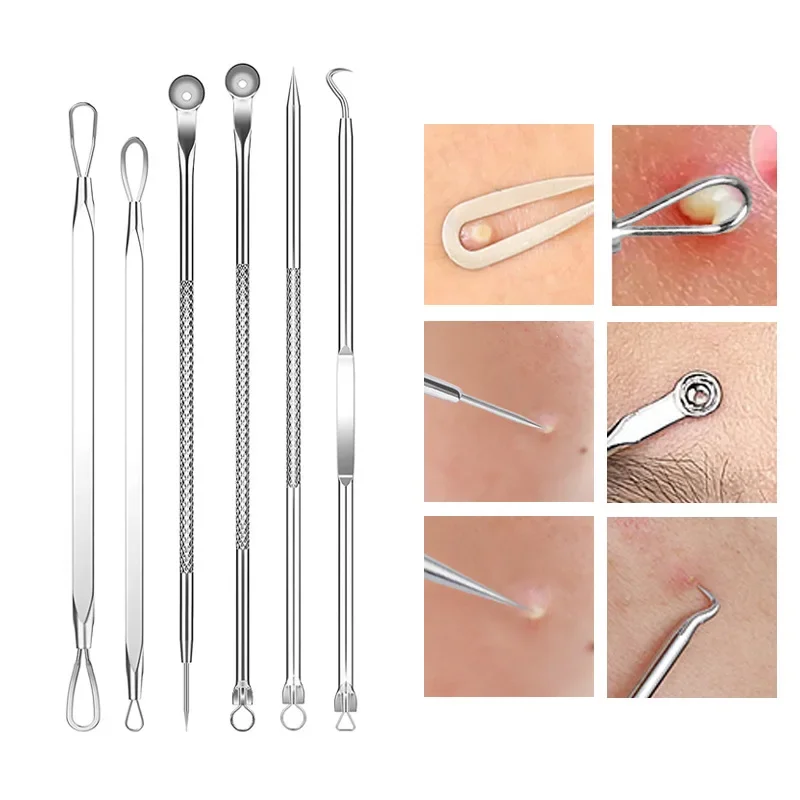 4-11Pcs Ingrown Hair Tweezers Acne Blackhead Removal Needles Black Dots Cleaner Deep Cleansing Pore Cleaner Face Skin Care Tools thumbnail 3