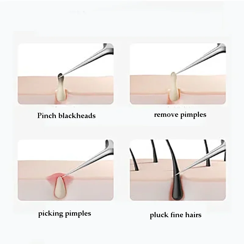 4-11Pcs Ingrown Hair Tweezers Acne Blackhead Removal Needles Black Dots Cleaner Deep Cleansing Pore Cleaner Face Skin Care Tools thumbnail 5