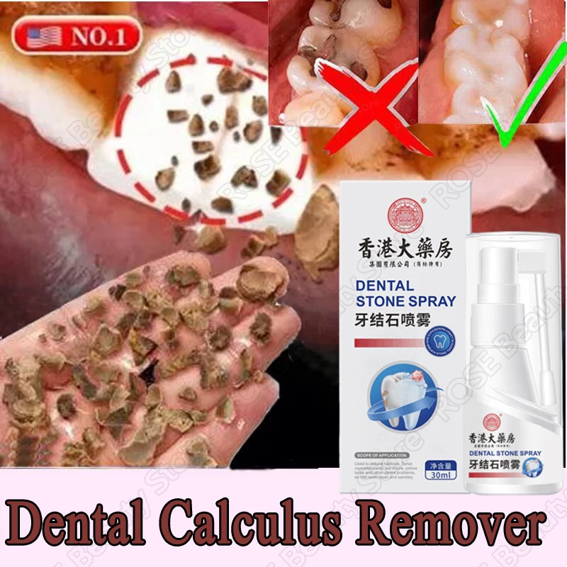 Dental Calculus Remover Teeth Whitening Spray Toothpaste Cleaning Oral Hygiene Removal Halitosis Plaque Stains Fresh Breath Care thumbnail 2