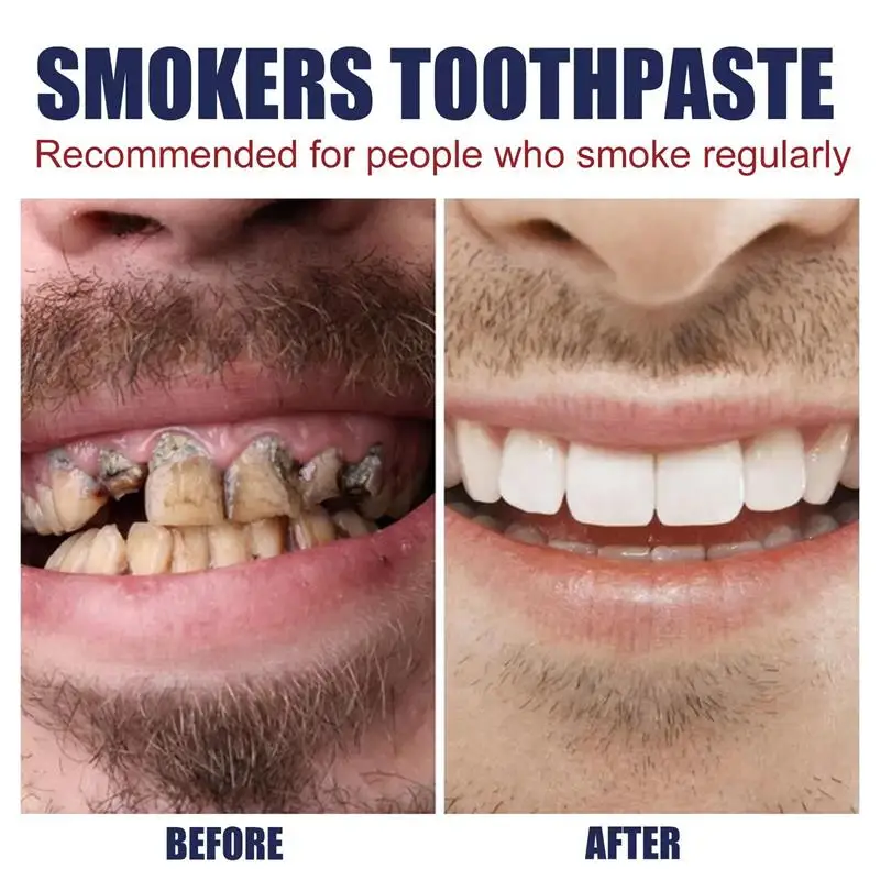 Dental Calculus Remover Teeth Whitening Spray Toothpaste Cleaning Oral Hygiene Removal Halitosis Plaque Stains Fresh Breath Care thumbnail 6