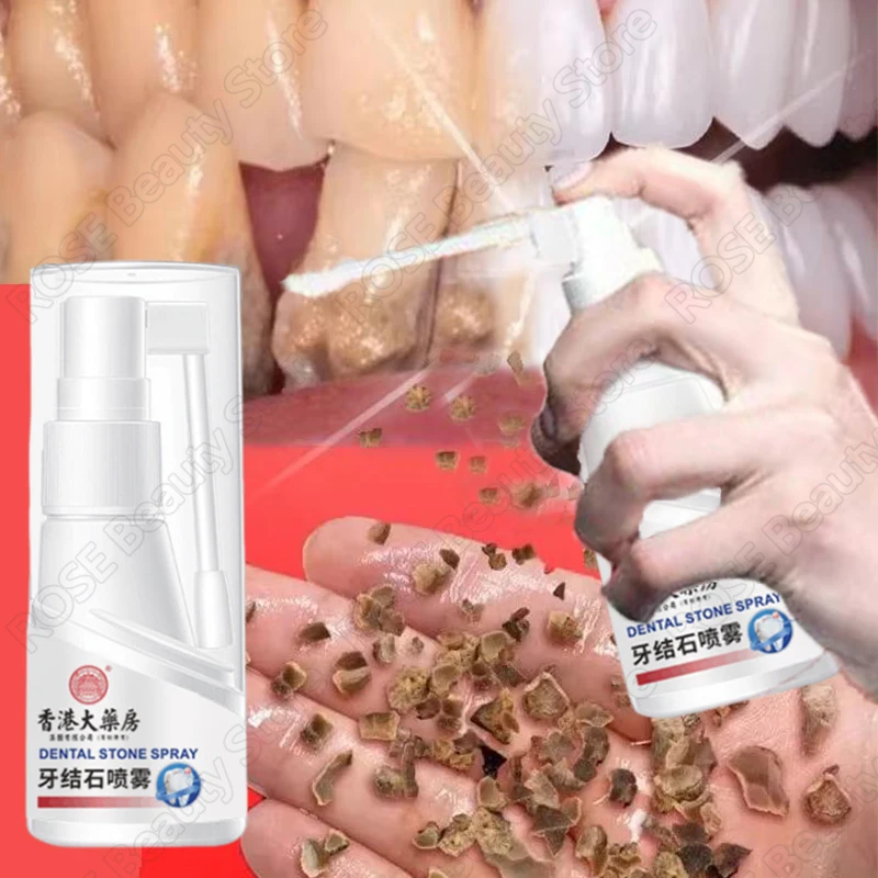 Dental Calculus Remover Teeth Whitening Spray Toothpaste Cleaning Oral Hygiene Removal Halitosis Plaque Stains Fresh Breath Care thumbnail 4