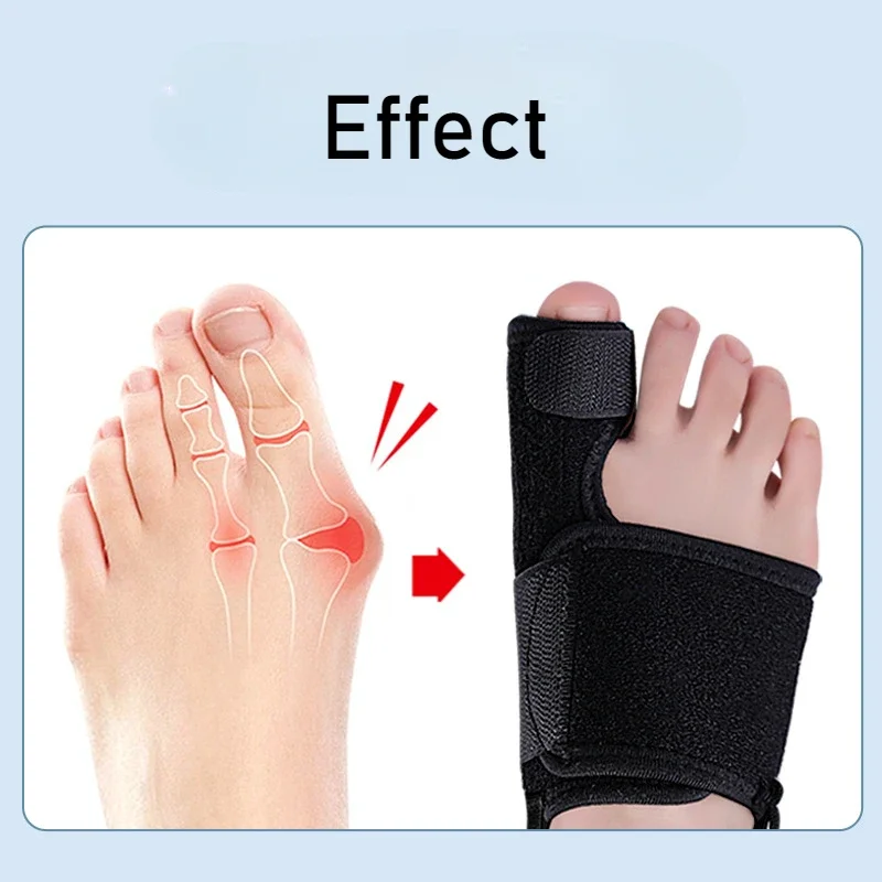 Flexible Splint Toe Separator Hallux Valgus Bunion Corrector Orthotics Feet Bone Thumb Adjuster Correction Pedicure Straightener thumbnail 4