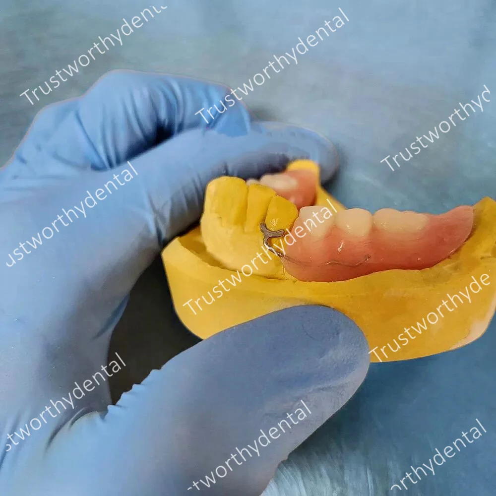 0.9mm Dental J Clasp Ball Retainer Roach Orthodontic Oblique Bar Y-Type Denture ScheuTeeth Position Hold thumbnail 4