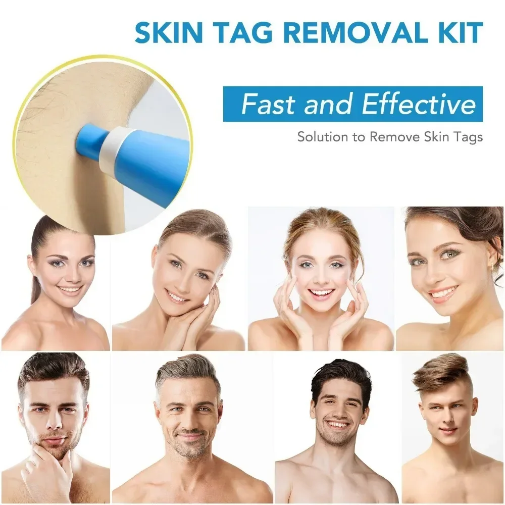2 In1 Painless Auto Skin Tag Mole Wart Removal Kit Cleaning Tools Face Skin Care Body Wart Dot Treatments Remover Beauty Health thumbnail 3