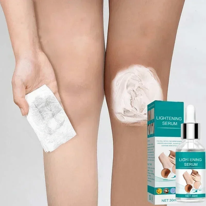Skin Whitening Serum Private Parts Underarm Bleaching Serum Whiten Butt Knee Brighten Inner Thigh Arm Body Remove Dark Melanin thumbnail 5