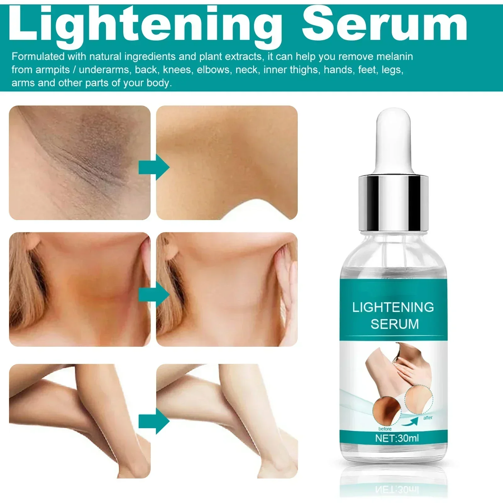 Skin Whitening Serum Private Parts Underarm Bleaching Serum Whiten Butt Knee Brighten Inner Thigh Arm Body Remove Dark Melanin thumbnail 3