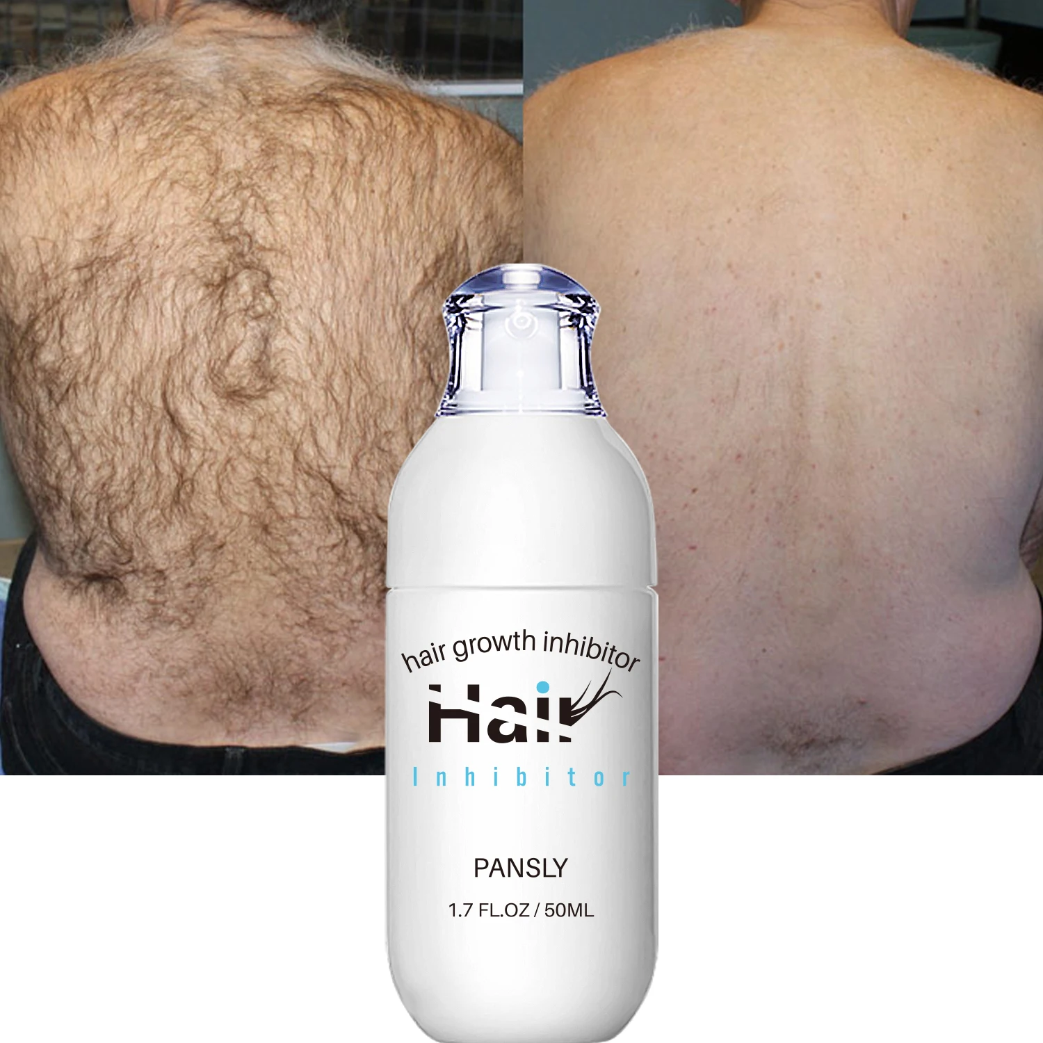 100ML Hair Removal Spray Hair Growth Inhibitor Spray Painless Hair Reduction Permanently Inhibits Hair Growth Skin Silky Smooth thumbnail 4