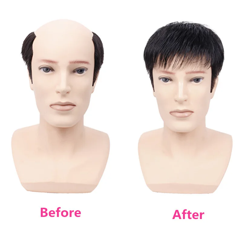 Men's fashion synthetic fiber wig short hair sales on top of the hair block to cover white hair Mediterranean bald hair patch thumbnail 2