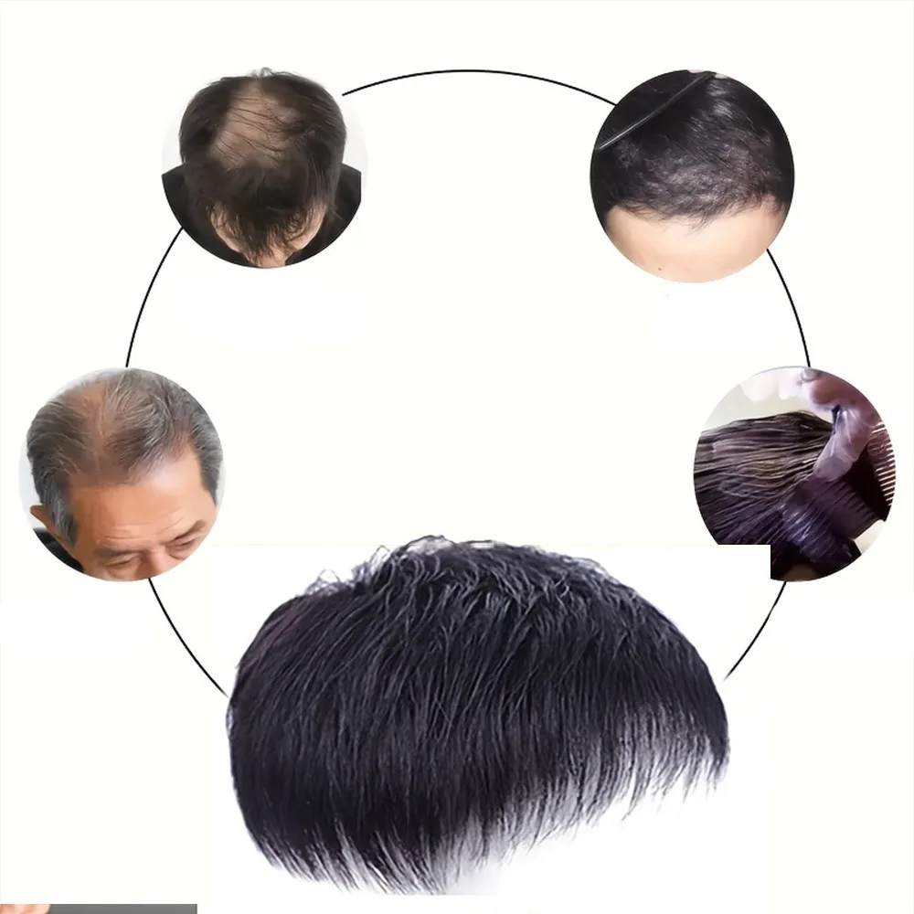 Men's fashion synthetic fiber wig short hair sales on top of the hair block to cover white hair Mediterranean bald hair patch thumbnail 5