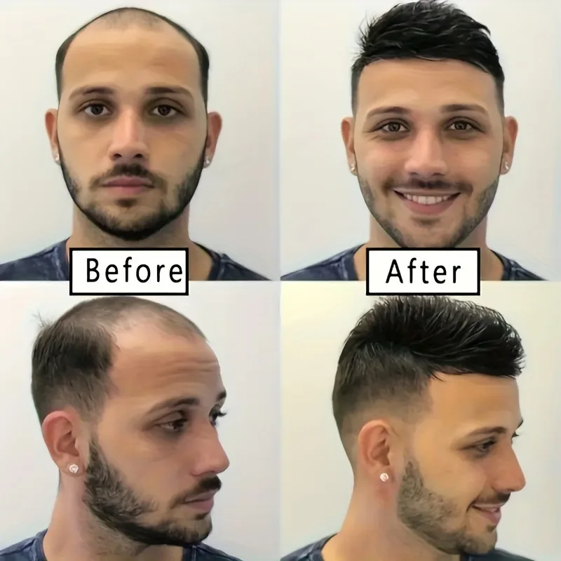 Men's fashion synthetic fiber wig short hair sales on top of the hair block to cover white hair Mediterranean bald hair patch thumbnail 3