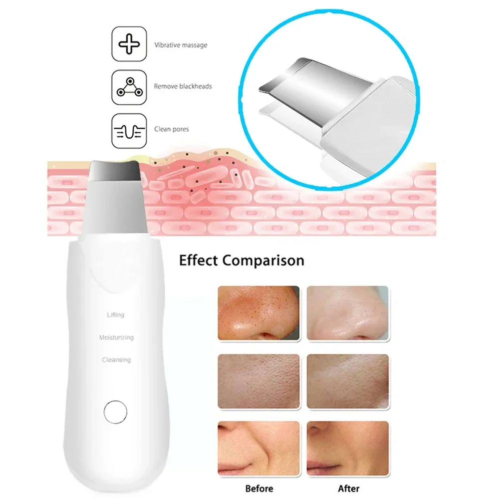 Professional No Ultrasonic Facial Skin Scrubber Ion Deep Face Cleaning Peeling Rechargeable Skin Care Device Beauty Instrument thumbnail 5