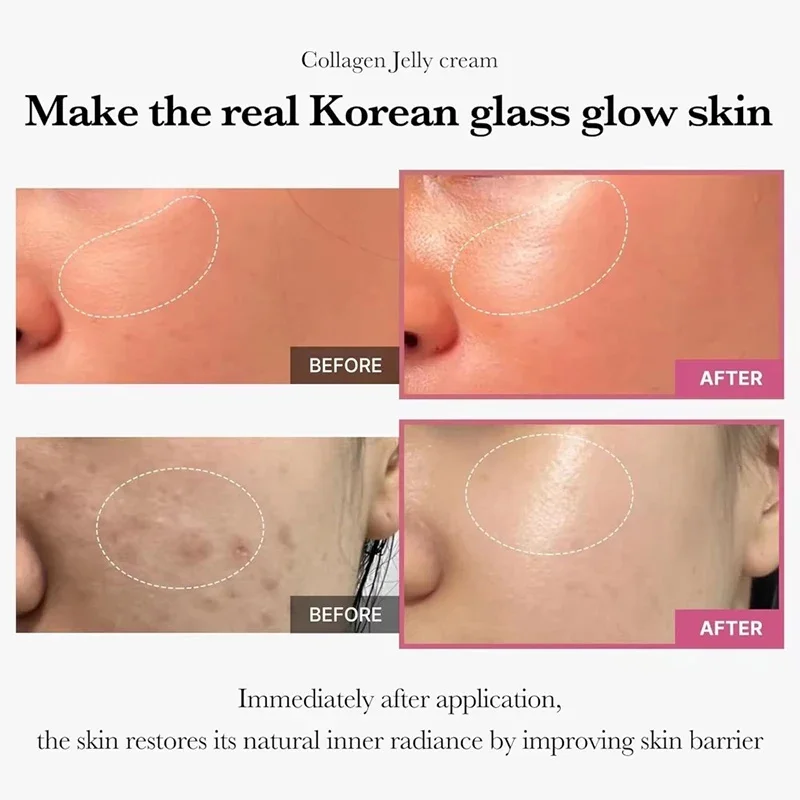 100g Jelly Face Cream Collagen Soft SPA Nourishing Moisturize Face Shrinks Pores Remove Comedones Jelly Essence Korean Skin Care thumbnail 2