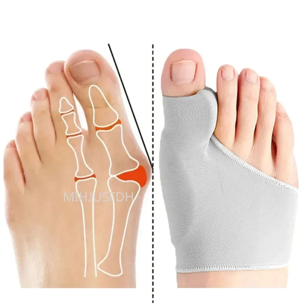 1Pair Toe Separator Hallux Valgus Bunion Corrector Orthotics Feet Bone Thumb Adjuster Correction Pedicure Sock Straightener