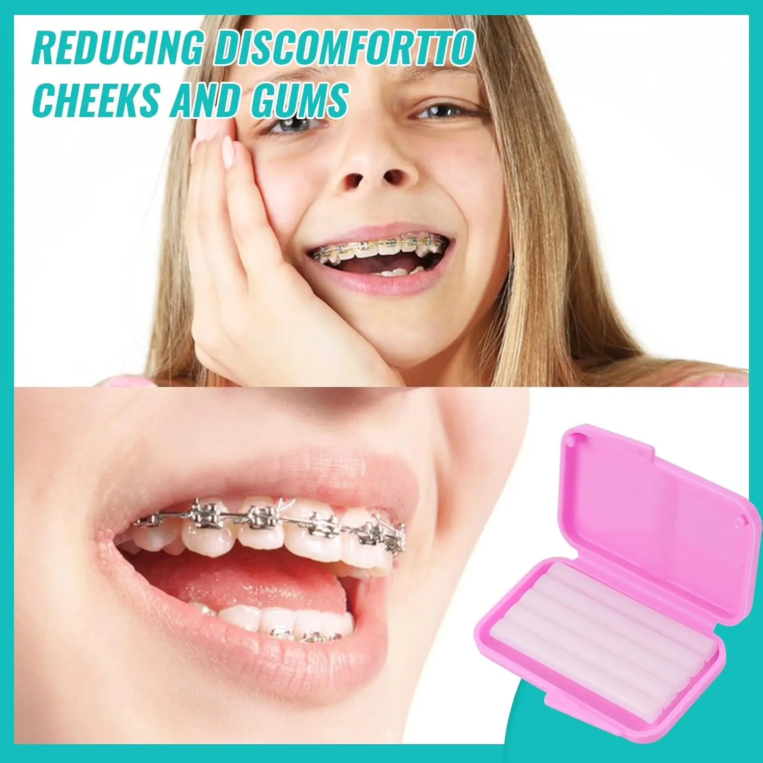 10 Boxes Dental Orthodontic Relief Wax for Bracket Patient Relief Protect Lips and Gums Irritation Fruit Flavour Wax thumbnail 3