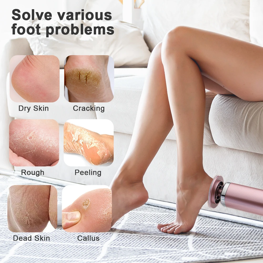 USB Rechargeable Electric Foot Care Callus Remover Nail Grinder Professional Foot Care File with replacement sandpaper tray thumbnail 4
