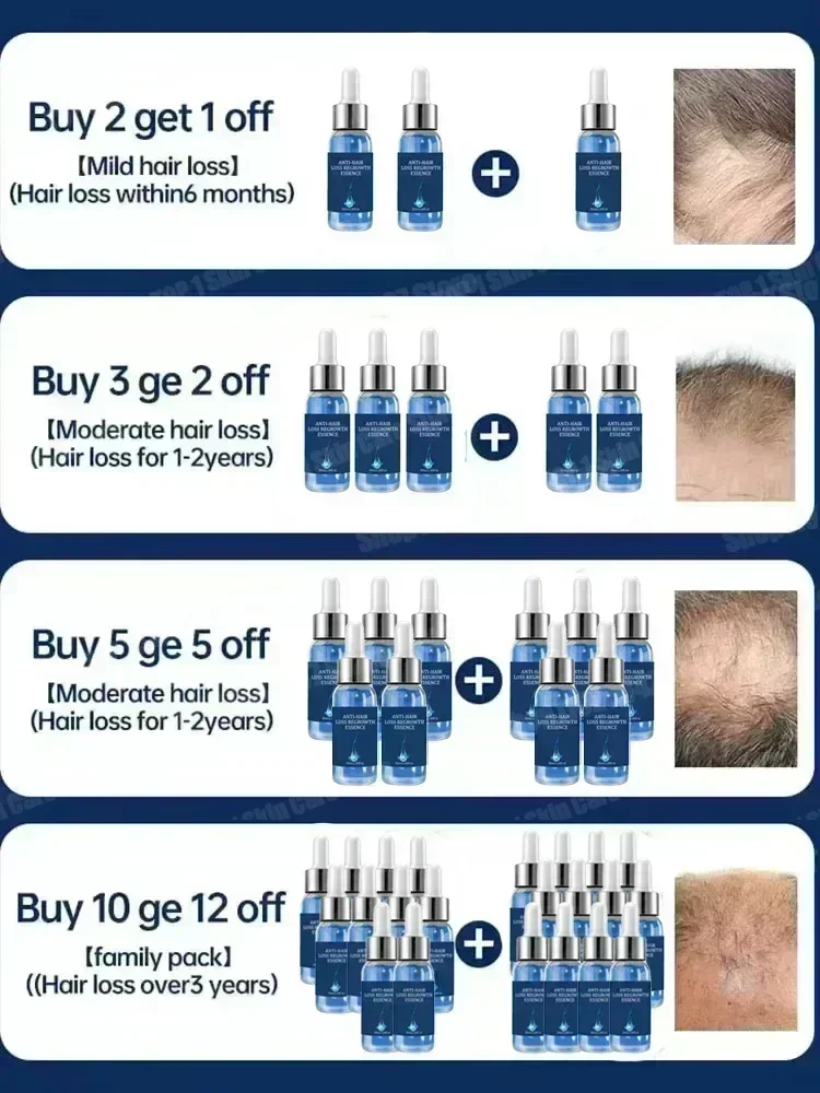 2 Hair growth and anti hair loss serum, anti hair loss scalp nutrition products thumbnail 6
