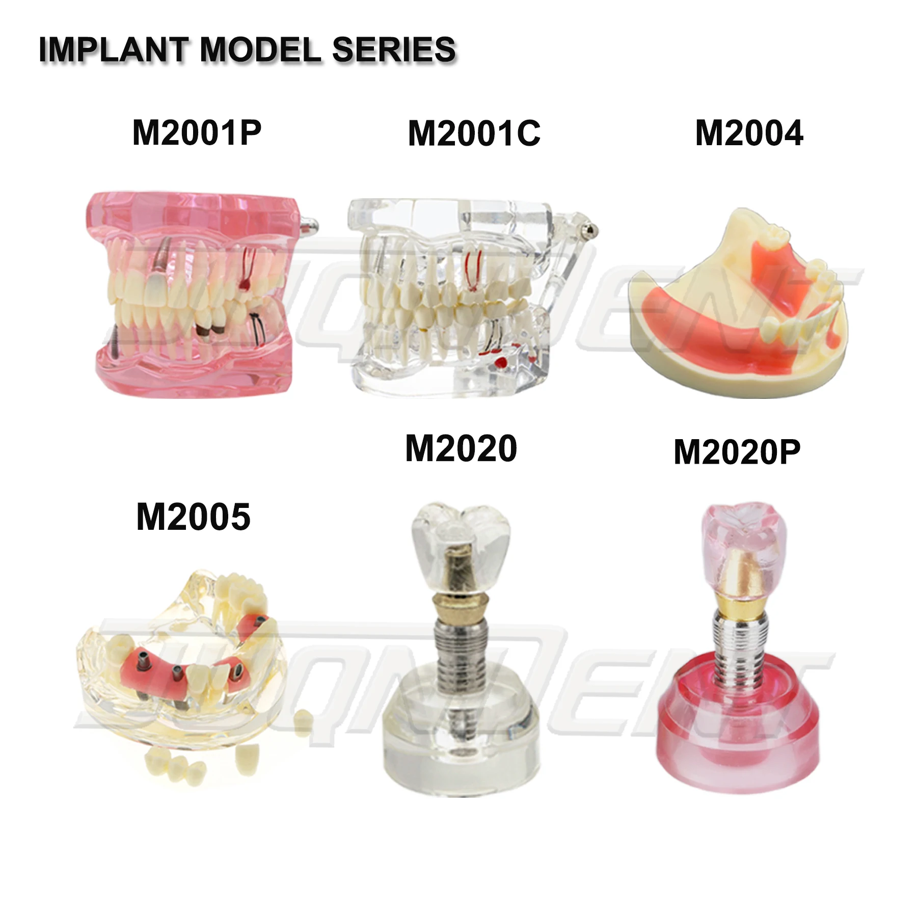 Dental Teeth Model Teaching Model Implant Model Removable Orthodontic Model Dentistry Dentist  Demo Studying Patient Education thumbnail 3