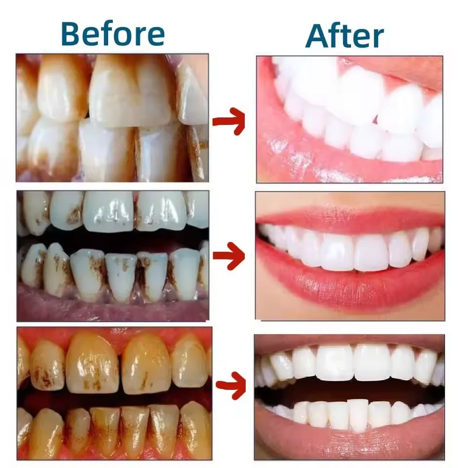 Teeth Whitening Toothpaste Serum Remove Plaque Stains Oral Hygiene Cleaning Dental Bleaching Tools Fresh Breath Tooth Care thumbnail 2