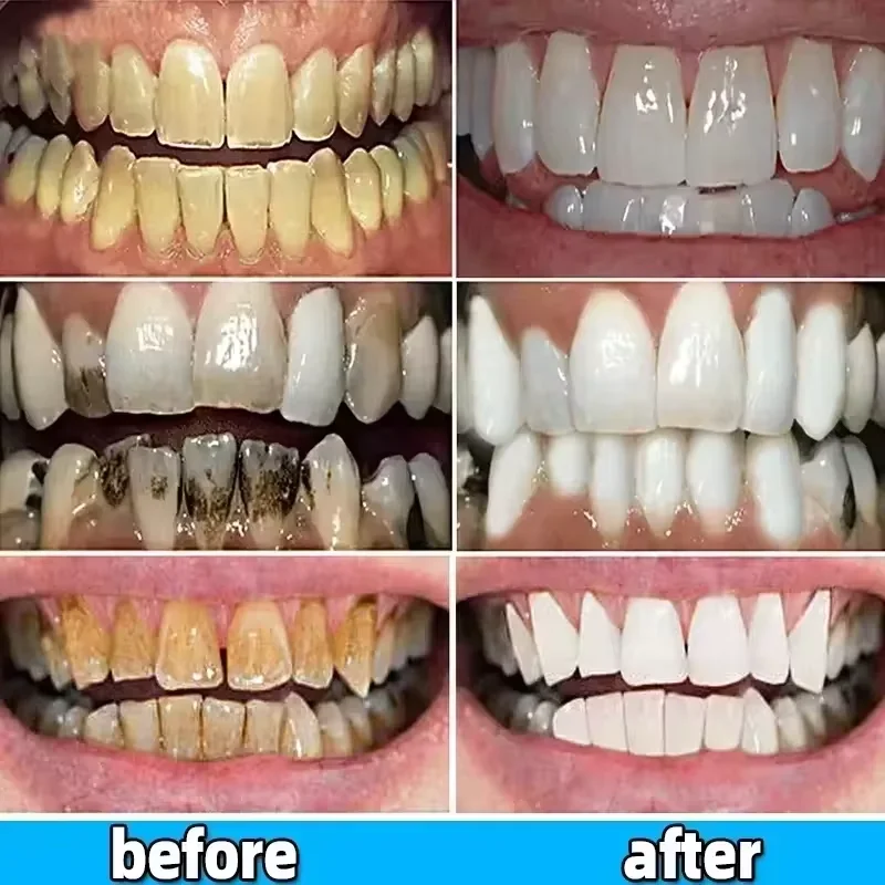 120g Probiotic Caries Toothpaste SP 4 Whitening Tooth Decay Repair Paste Teeth Cleaner Plaque Remover Fresh Breath Dental Care thumbnail 3