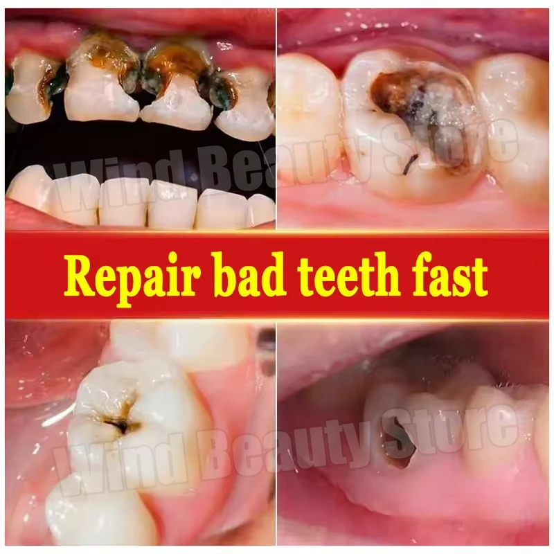 120g Probiotic Caries Toothpaste SP 4 Whitening Tooth Decay Repair Paste Teeth Cleaner Plaque Remover Fresh Breath Dental Care thumbnail 2