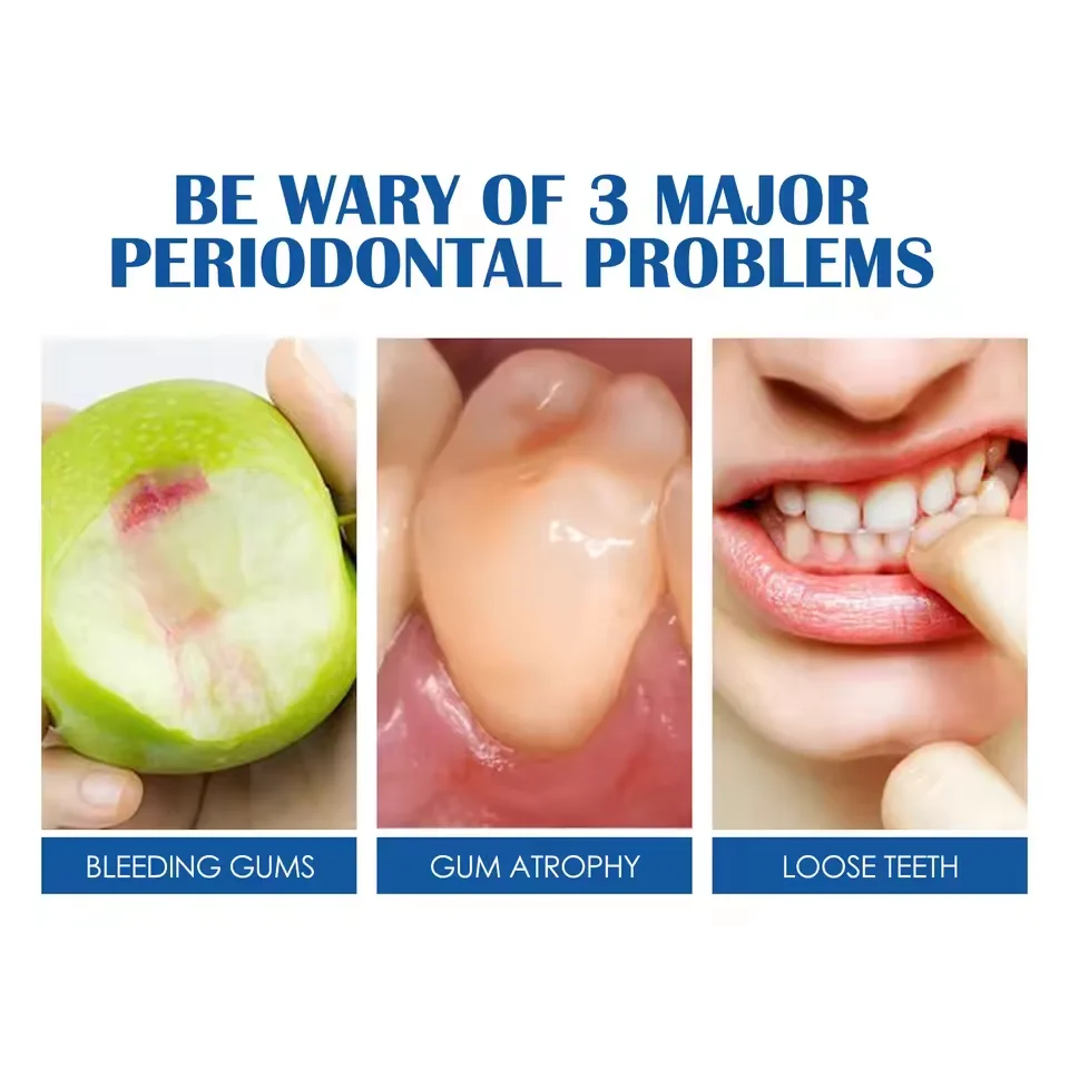 120g Probiotic Caries Toothpaste SP 4 Whitening Tooth Decay Repair Paste Teeth Cleaner Plaque Remover Fresh Breath Dental Care thumbnail 4