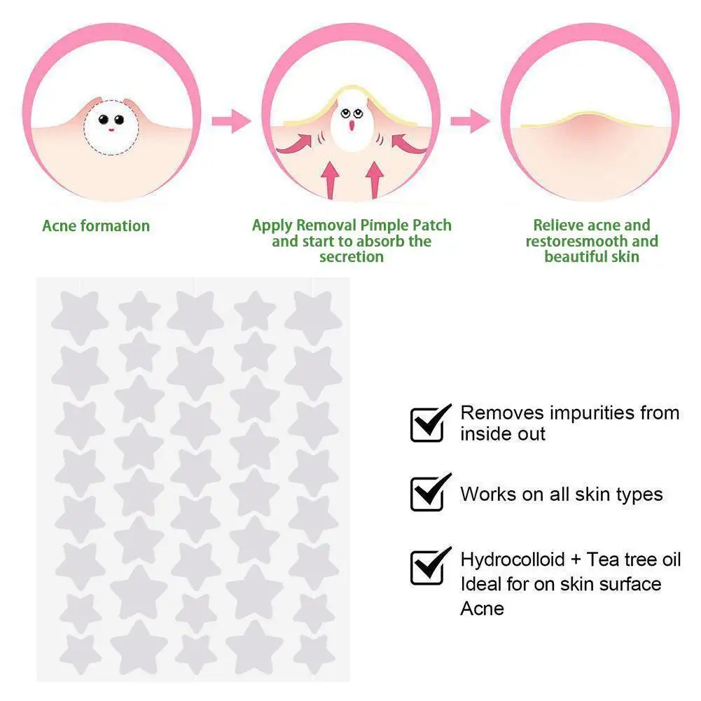 Colorful Star Shaped PE Pimple Patches Acne Cover Invisible Removal Skin Care Stickers Face Spot Concealer Beauty Makeup Tools thumbnail 5